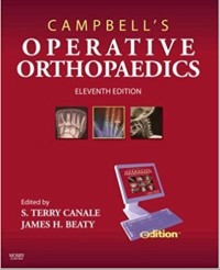 OPERATIVE ORTHOPAEDHICS VOLUME II